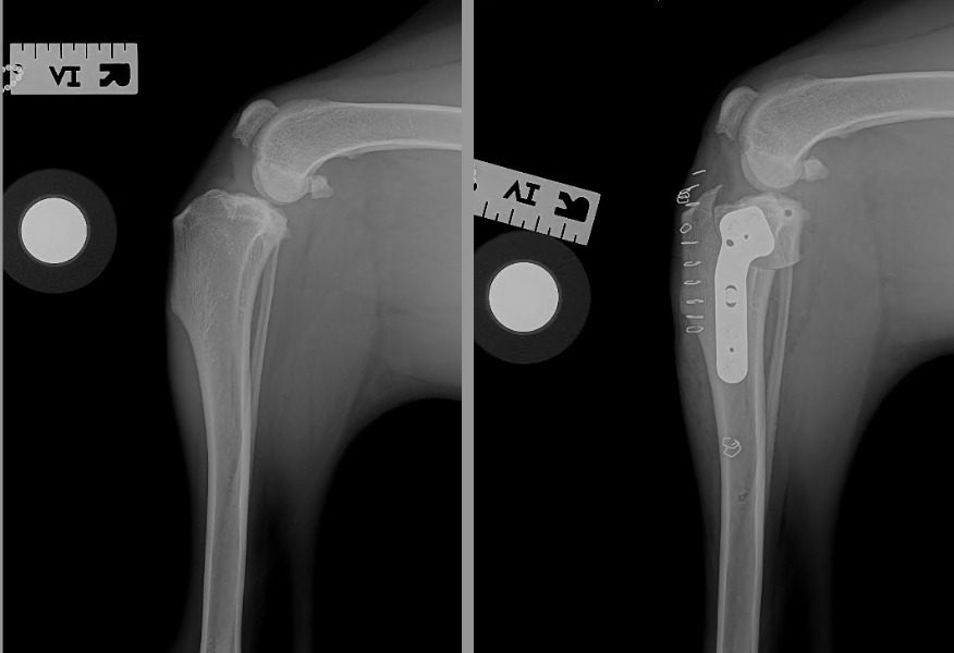 Arthroscopic Surgery before and after