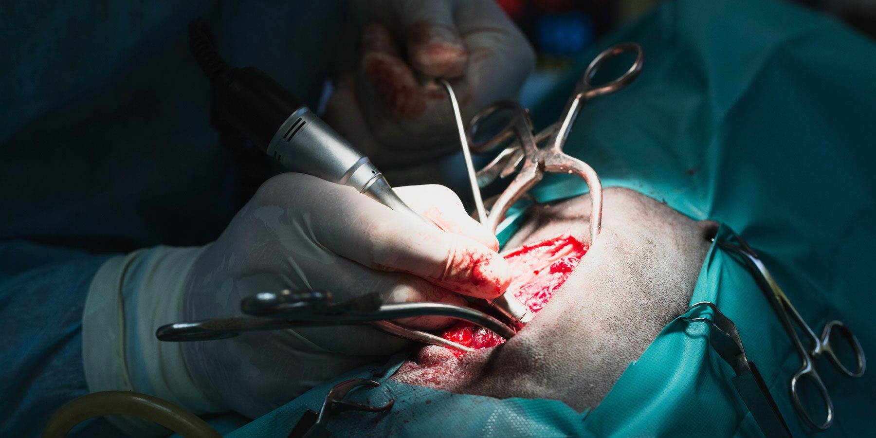 Surgeon Performing Orthopedic Surgery